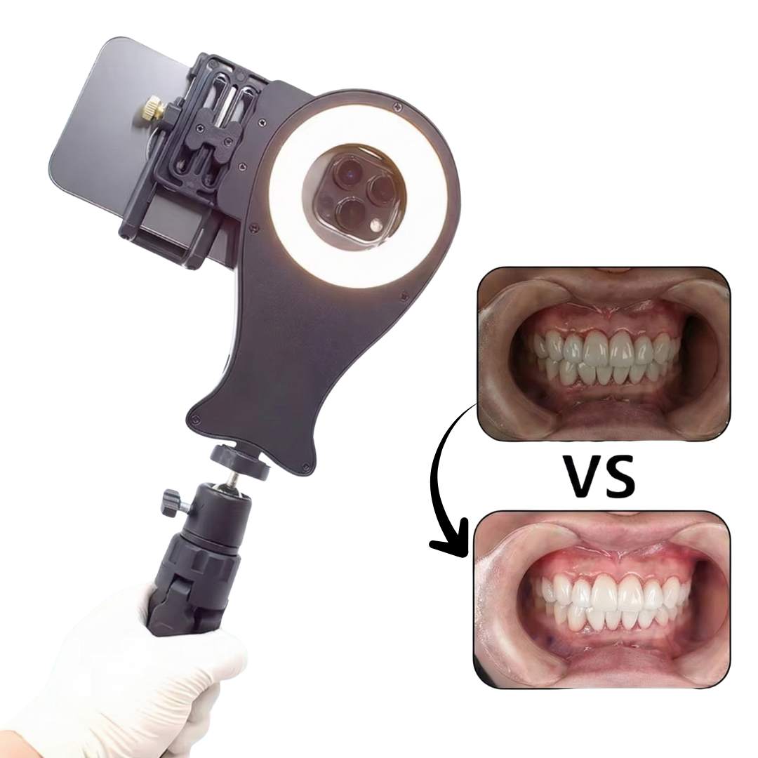 Oral Photography Stand V4 – compatible with any iPhone and Android model