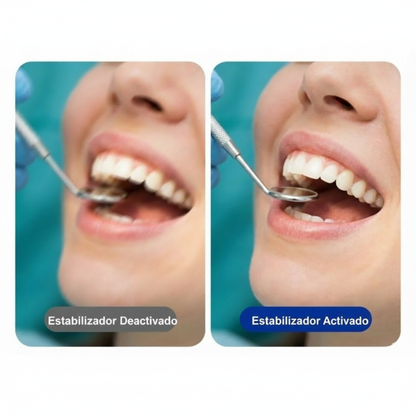 Recording camera for medical, dental, and aesthetic procedures – 4K at 30 FPS